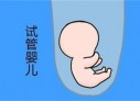 培养苏州捐卵宝宝艺术细胞的小技巧